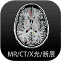 影像解剖图谱app